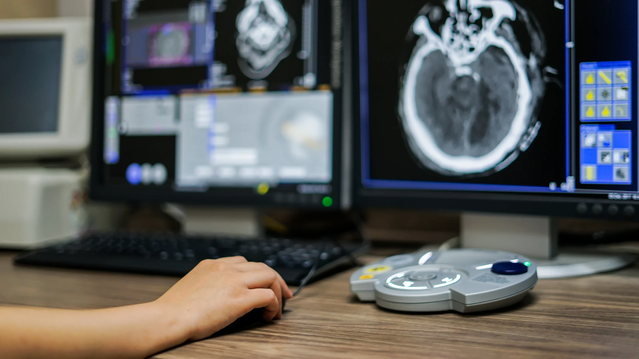 علاج الأورام بالأشعة التداخلية في تركيا